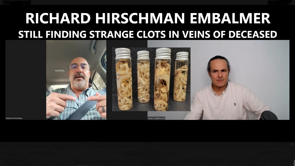 Richard Hirschman Embalmer – Still Finding Strange Clots in Veins of Deceased